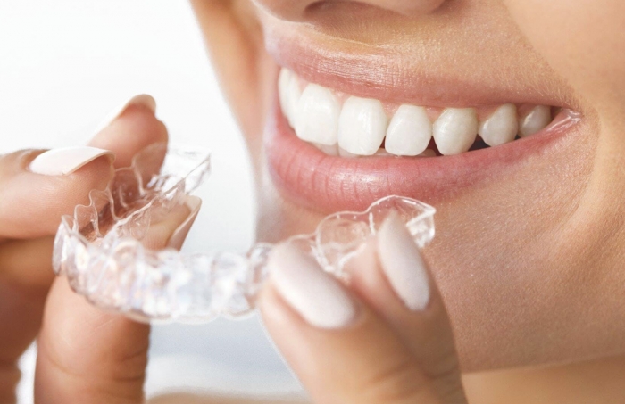 ¿El uso de brackets pueden hacerte más vulnerable ante la enfermedad gingival? La mejor manera de mantener sanos tus dientes y encías.