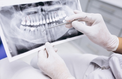Hábitos comunes que pueden dañar tus dientes