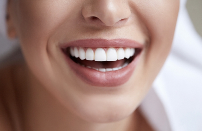 ¿Qué es la sonrisa gingival? Causas y tratamiento