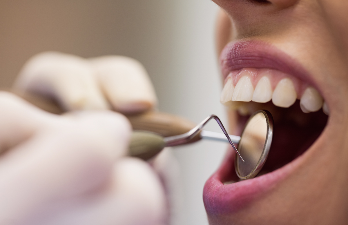 Manchas en los dientes: ¿Por qué aparecen? ¿Es posible eliminarlas?